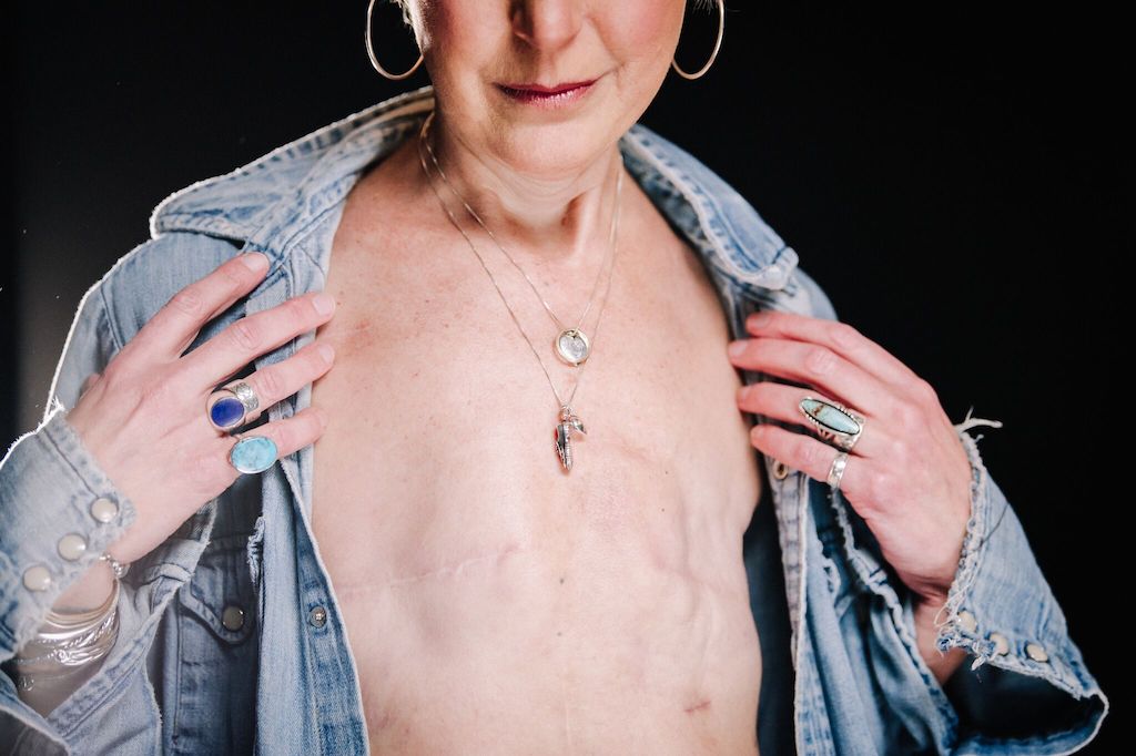 Breast Cancer Survivor Marianne - Portrait 2 Breast Cancer Survivor Marianne - Portrait 2